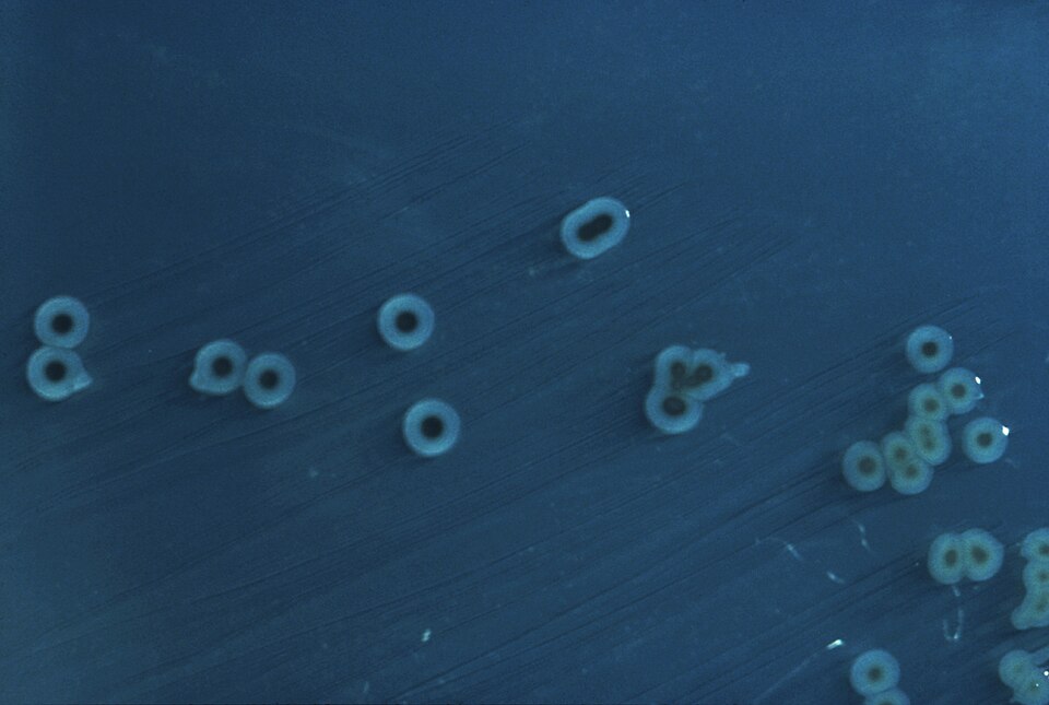 Colonies of pathogenic bacteria growing on an agar culture plate - Salmonella enterica (serovar typhimurium)