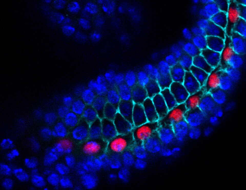 The insect (Drosophila) hindgut epithelium is composed of a variety of cells. Acquired with a Leica SP5 confocal microscope.