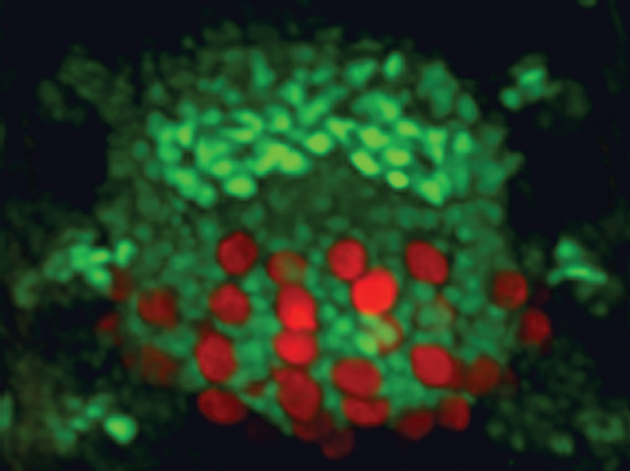 Fruit Fly Study Finds Gut Cells Sense Hunger Through Water Content, Not Nutrients