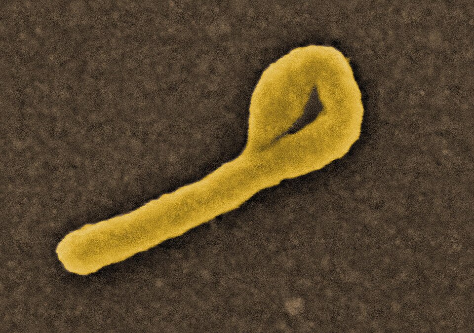 Scanning electron micrograph of Ebola virus budding from the surface of a Vero cell (African green monkey kidney epithelial cell line.NIAID