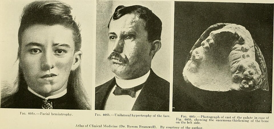 Identifier: internalmedicine02wils (find matches)
Title: Internal medicine; a work for the practicing physician on diagnosis and treatment, with a complete Desk index
Year: 1920 (1920s)
Authors:  Wilson, J. C. (James Cornelius), 1847-1934 Potter, Nathaniel Bowditch, 1869-1919
Subjects:  Medicine Dia