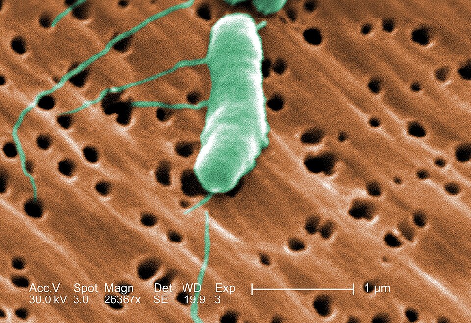 Flesh-Eating Bacteria Kills Seven People Along Gulf Coast This Summer