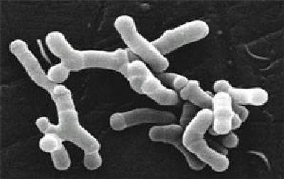 Bifidobacterium longum en microscopie électronique