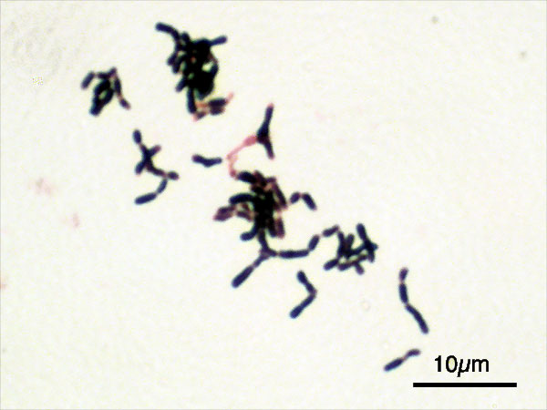 microscopic image of Bifidobacterium adolescentis ATCC 15703. Gram staining, magnification:1,000.