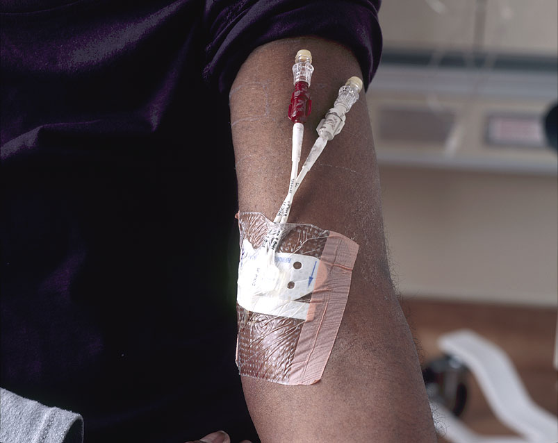 Mount Sinai Study Finds Chemotherapy-Free Option Shows Promise for Metastatic Breast Cancer