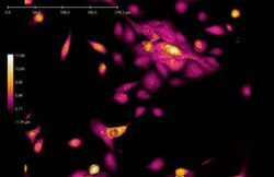 Quantitative phase contrast microscopy video showing cell division of unlabeled JIMT-1 breast cancer cells. During the video, spanning over 72 hours, one cell divides into three daughter cells (seen on top of the cell cluster in the upper right portion of the image). One of the daughter cell dies an