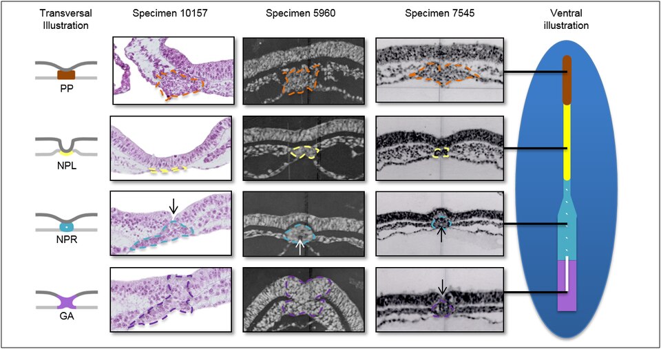 S1 Fig. Histological sections of three stage 8 (17–19 days) human embryos.

Specimens Nos. 10157, 5960 and 7545 of the Carnegie collection with cross-sections at the same level, matching the black lines in the ventral illustration. The notochordal process becomes smaller, containing less nuclei or c