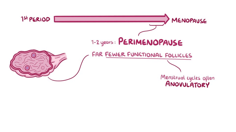 What is menopause? Menopause refers to the natural halting of the monthly menstrual cycles because of the depletion of ovarian follicles. It’s usually considered that a woman has entered menopause when more than 1 year has passed since her last menstrual period.