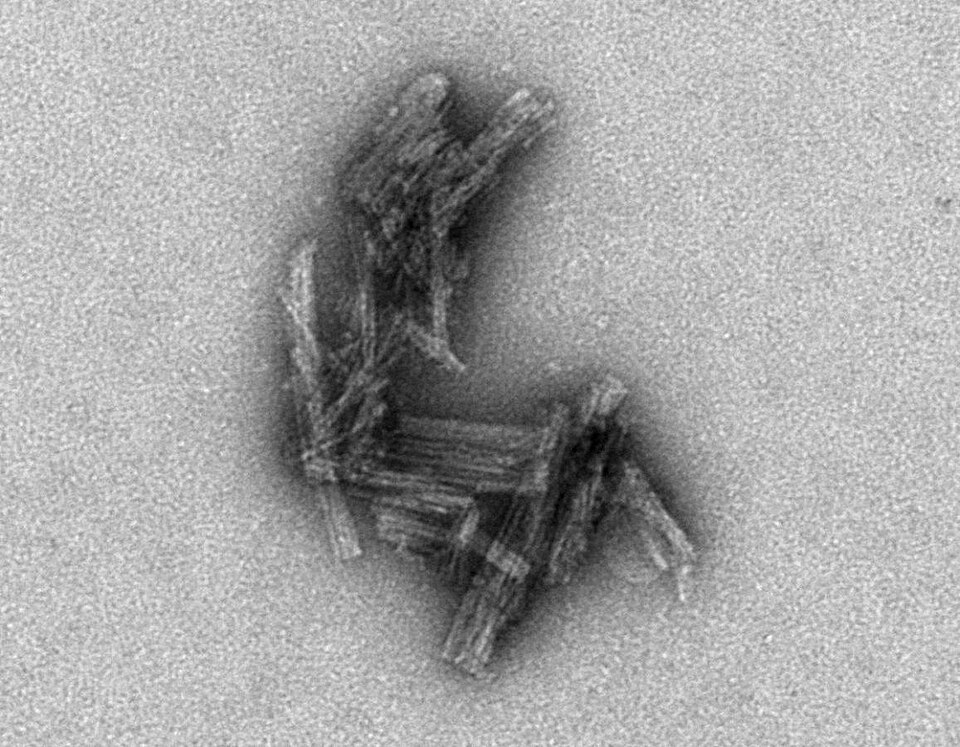 An ultrasensitive test has been developed that detects a corrupted protein associated with Alzheimer’s disease and chronic traumatic encephalopathy (CTE), a condition found in athletes, military veterans, and others with a history of repetitive brain trauma. This advance could lead to early diagnosi