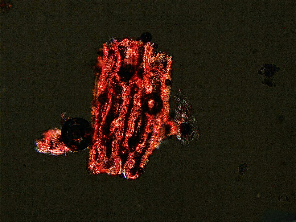 My images are of reference collection work for archaeological dental calculus - i.e. looking at plants, animals and fungi from the inside to better understand them when I encounter them in archaeological samples. On this image you can see a very demonic-looking piece of cranberry! This image was alt
