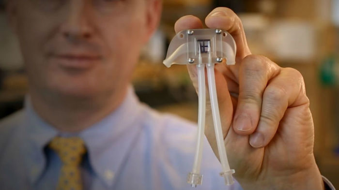 Early Use of Rasburicase Reduces Kidney Failure Risk in Cancer Patients