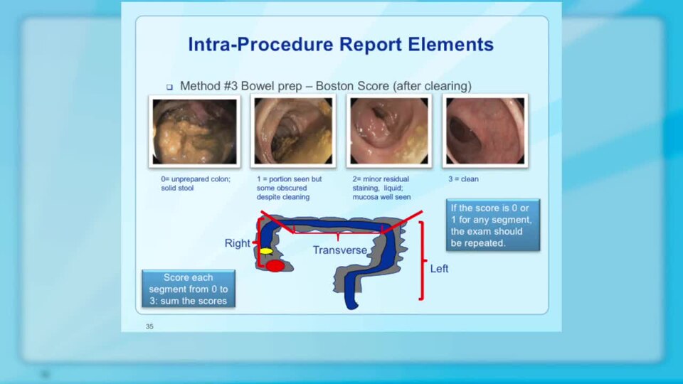 Part 2 of the Endoscopist Version CME focuses on colonoscopy and includes pre-procedure considerations for ensuring that colonoscopy is appropriate, ways to achieve good bowel preparation, the elements required for complete reporting, effective communication with referring providers and patients, an
