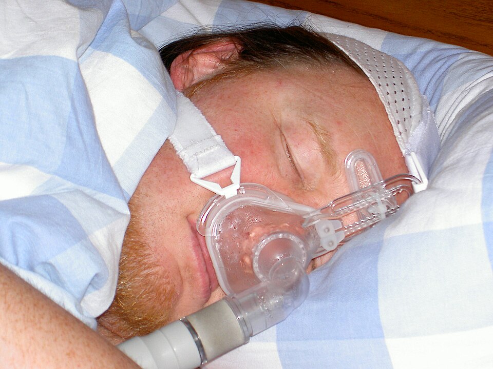 GLP-1 Weight Loss Drugs Show Strong Results Against Obstructive Sleep Apnea