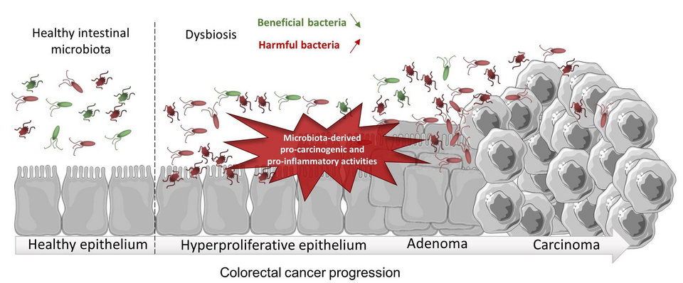 Scientists Identify Gut Pathways That May Connect Digestion to Mental Health