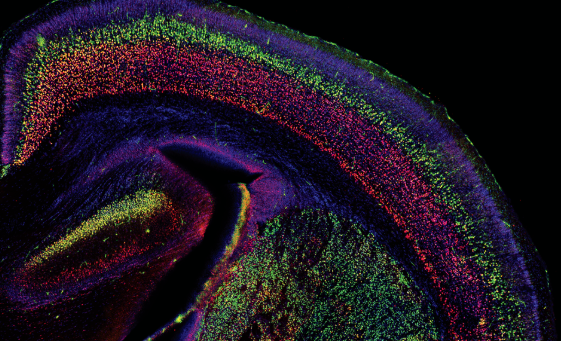 Scientists Find Different Layers of the Brain Change in Different Ways During Learning