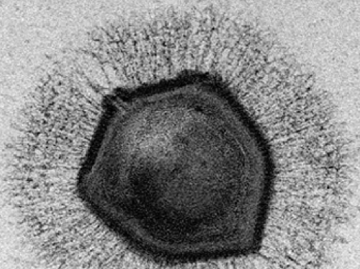 Electron microscopic image of a mimivirus - journal