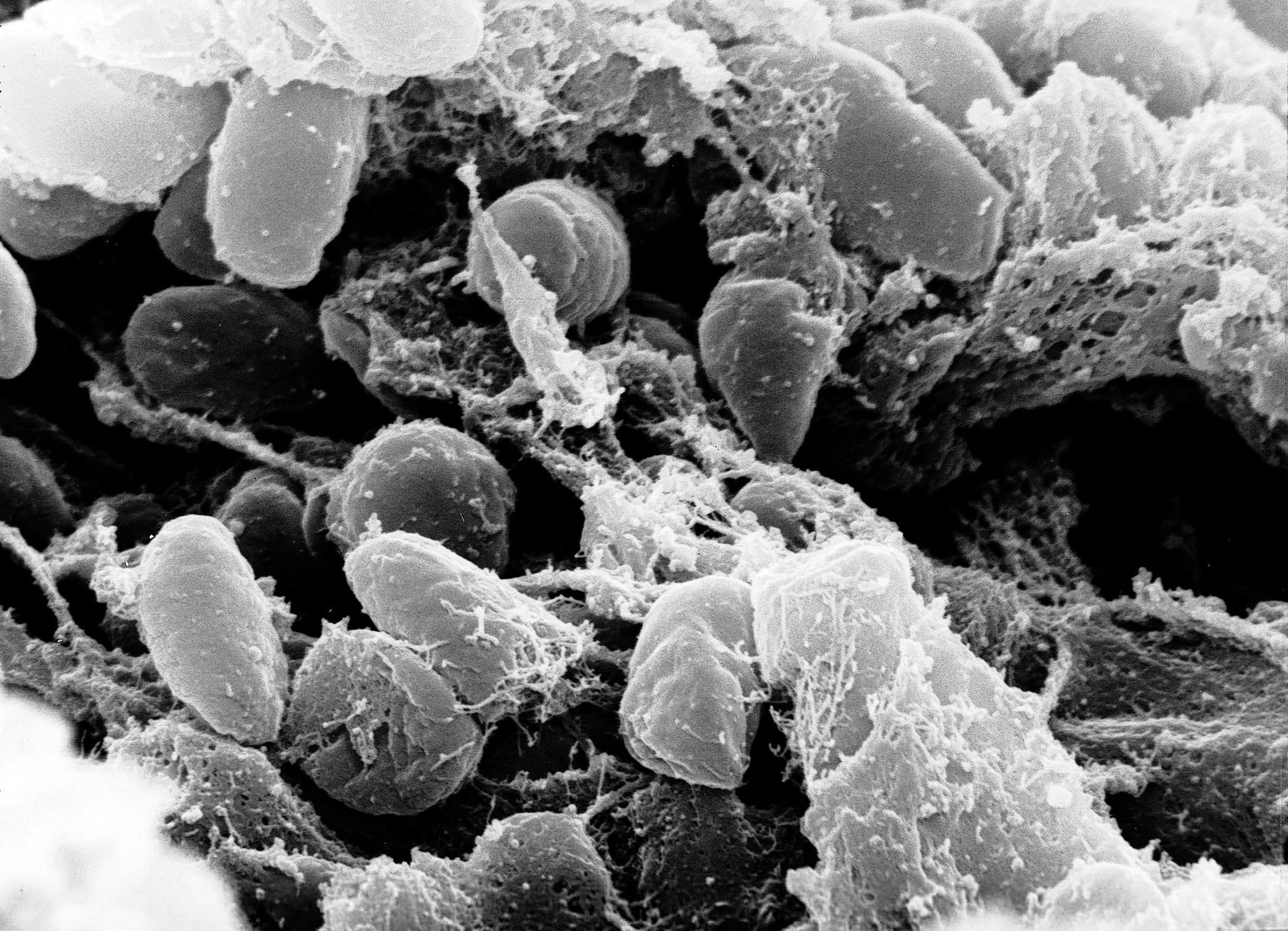 Russian Lab Worker Death Raises Fears of Possible Pneumonic Plague