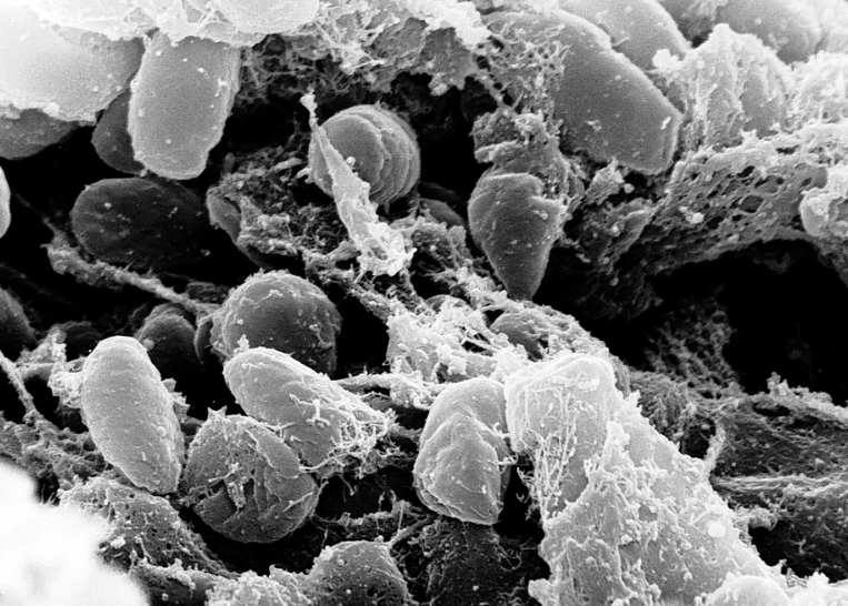 Scanning electron microphotograph depicting a mass of Yersinia pestis bacteria